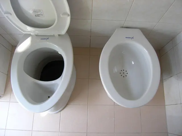 Deep Cleaning Toilet: Eliminating Persistent Urine Marks and Grimy Accumulations