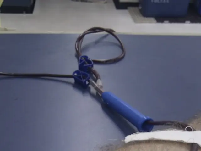 Experienced Nephrologist in Chennai Specializing in Comprehensive Kidney Treatment